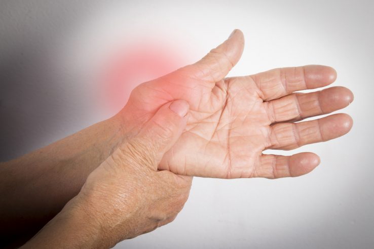 Hand Deformed From Rheumatoid Arthritis. Studio shot. Pain condition. In red